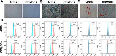 Comparison of the therapeutic effects of human umbilical cord blood-derived mesenchymal stem cells and adipose-derived stem cells on erectile dysfunction in a rat model of bilateral cavernous nerve injury